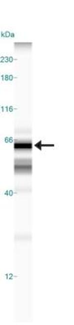 TOM70 Antibody in Western Blot (WB)