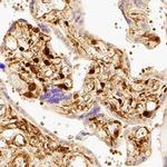 YAP1 Antibody in Immunohistochemistry (Paraffin) (IHC (P))