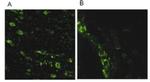 LRRK2 Antibody in Immunocytochemistry (ICC/IF)