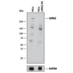 LRRK2 Antibody in Western Blot (WB)