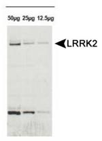 LRRK2 Antibody in Western Blot (WB)