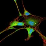 NSE Antibody in Immunocytochemistry (ICC/IF)