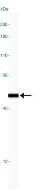 NSE Antibody in Western Blot (WB)