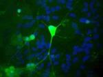 PGP9.5 Antibody in Immunocytochemistry (ICC/IF)