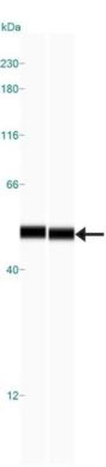 OXPAT Antibody in Western Blot (WB)