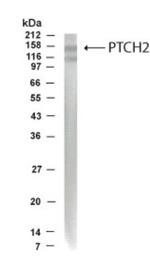 PTCH2 Antibody in Western Blot (WB)