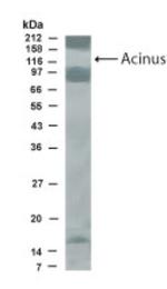 Acinus Antibody in Western Blot (WB)