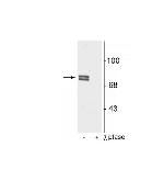 Phospho-ALOX5 (Ser523) Antibody in Western Blot (WB)