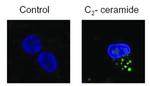 LC3B Antibody in Immunocytochemistry (ICC/IF)