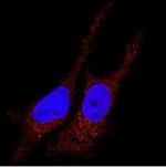 LC3B Antibody in Immunocytochemistry (ICC/IF)