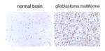 LC3B Antibody in Immunohistochemistry (Paraffin) (IHC (P))