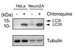 LC3B Antibody in Western Blot (WB)