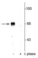 Phospho-PAK1/2/3 (Thr402) Antibody in Western Blot (WB)