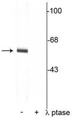 Phospho-Synaptotagmin 1 (Thr202) Antibody in Western Blot (WB)