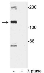 Phospho-TAOK2 (Ser181) Antibody in Western Blot (WB)