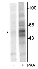 Phospho-TPH1 (Ser58) Antibody in Western Blot (WB)