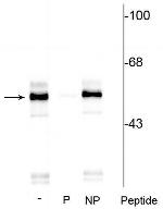 Phospho-TPH1 (Ser260) Antibody in Western Blot (WB)