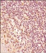 LMO2 Antibody in Immunohistochemistry (Paraffin) (IHC (P))