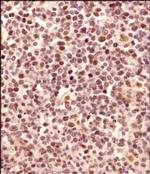 LMO2 Antibody in Immunohistochemistry (Paraffin) (IHC (P))