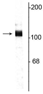 Amyloid Precursor Protein Antibody in Western Blot (WB)