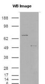 S100A9 Antibody in Western Blot (WB)