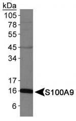 S100A9 Antibody in Western Blot (WB)