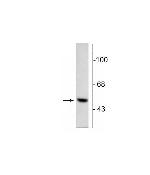 DOPA Decarboxylase Antibody in Western Blot (WB)