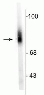 Dopamine beta Hydroxylase Antibody in Western Blot (WB)