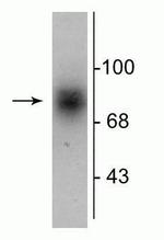 Dopamine Transporter Antibody in Western Blot (WB)