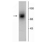 Dopamine Transporter Antibody in Western Blot (WB)