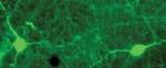 Tyrosine Hydroxylase Antibody in Immunohistochemistry (IHC)