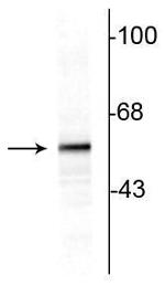 Tyrosine Hydroxylase Antibody in Western Blot (WB)