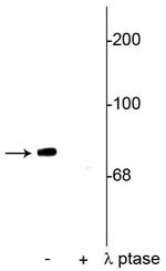 Phospho-Synapsin 1 (Ser549) Antibody in Western Blot (WB)