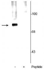 Phospho-Synapsin 1 (Ser62, Ser67) Antibody in Western Blot (WB)