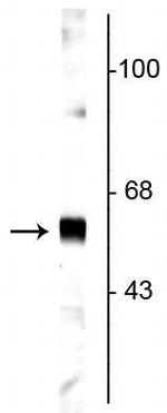 Synaptotagmin 1 Antibody in Western Blot (WB)