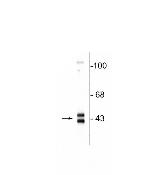 ERK1/ERK2 Antibody in Western Blot (WB)