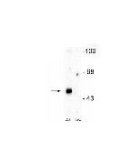 GABRA2 Antibody in Western Blot (WB)