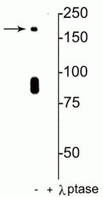 Phospho-NMDAR2B (Ser1480) Antibody in Western Blot (WB)