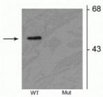 Phospho-Parkin (Ser378) Antibody in Western Blot (WB)