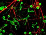 alpha Internexin Antibody in Immunocytochemistry (ICC/IF)