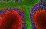 alpha Internexin Antibody in Immunohistochemistry (IHC)