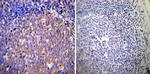 Glucocorticoid Receptor alpha Antibody in Immunohistochemistry (Paraffin) (IHC (P))