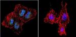 ATRIP Antibody in Immunocytochemistry (ICC/IF)