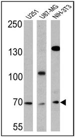 BMAL1 Antibody in Western Blot (WB)