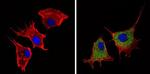 Angiostatin Antibody in Immunocytochemistry (ICC/IF)