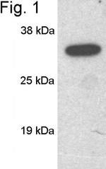 SCAMP1 Antibody in Western Blot (WB)