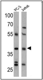 CNR2 Antibody in Western Blot (WB)