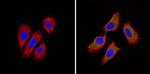 BACE2 Antibody in Immunocytochemistry (ICC/IF)