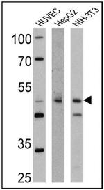 TPH1 Antibody in Western Blot (WB)