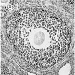 FOXL2 Antibody in Immunohistochemistry (IHC)